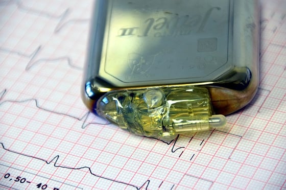 pacemaker-1943662_640
